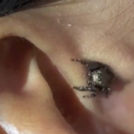 【衝撃映像】耳に虫がはいったときの対処法・・・これは絶対覚えとけｗ