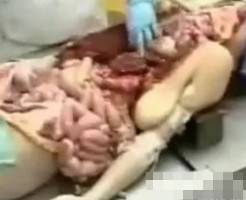 【人体解剖】解剖好きでひたすら見たい人のための動画アップしますねｗ