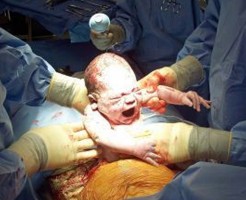 【妊婦解剖】死体だけど帝王切開で胎児取り出すときはこんな感じ　　※長編グ◯動画