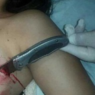 【画像2枚】ガールフレンドがセックスさせてくれなかったのでナイフで胸を刺す…。※閲覧注意