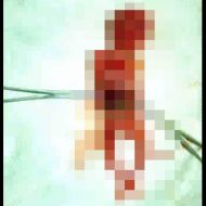 【グロ画像】撃たれた女の子が妊婦かつ子宮に被弾した結果・・・　※閲覧注意
