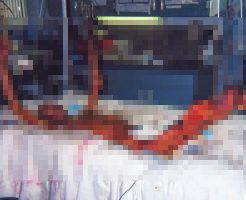 【グロ画像】大量の放射能を浴びた作業員が死亡した国内事故　東海村臨界事故