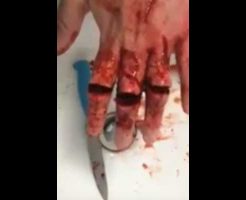 【閲覧注意】メンヘラさん　手首を切ることに飽きて代わりに指を３本切って使い物にならなくした模様・・・ ※グロ動画
