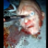 【グロ動画】生首から眼球をナイフでエグリ取っていくブラジルの少年による死体解体映像がクッソ怖い・・・