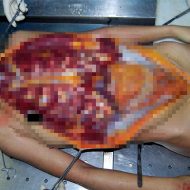 【グロ画像】水洗いした若い女の子の死体　脳や心臓などの臓器を解剖していく剖検写真集・・・