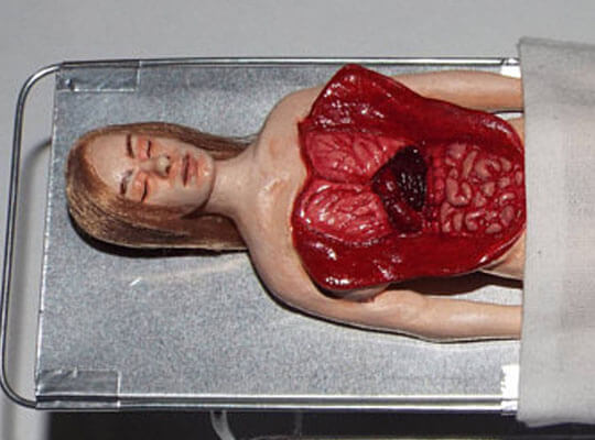 美人女性 全裸死体 解剖 女性性器 