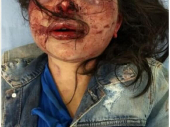 えげつないほどﾎﾞｯｺﾎﾞｺに顔を殴られて殺害された女性の画像が惨い…