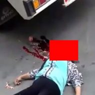 トラックに轢かれてしまった女性の頭部は…これは不運の事故だったとしか言えない