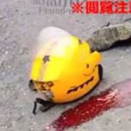 【閲覧注意】バイク事故で頭を強く打ったライダー、顔面の半分が崩壊…